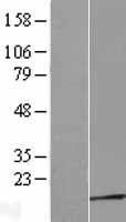 TPRKB Human Over-expression Lysate