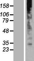 GOLT1B Human Over-expression Lysate