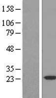 PPPDE1 (DESI2) Human Over-expression Lysate