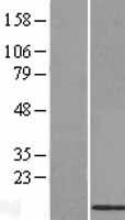 BRP44L (MPC1) Human Over-expression Lysate