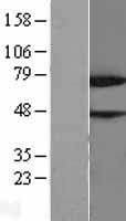 NYREN18 (NUB1) Human Over-expression Lysate