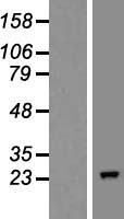 COMMD10 Human Over-expression Lysate