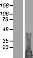 RAB4B Human Over-expression Lysate
