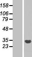 CYB5R2 Human Over-expression Lysate