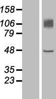 Endomucin (EMCN) Human Over-expression Lysate