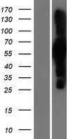 Apc7 (ANAPC7) Human Over-expression Lysate