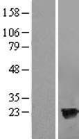 HPCAL4 Human Over-expression Lysate