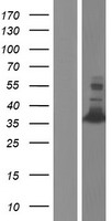 CED6 (GULP1) Human Over-expression Lysate