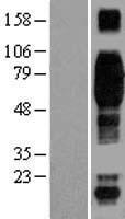 CD244 Human Over-expression Lysate