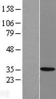 HSD17B7 Human Over-expression Lysate