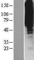 ISYNA1 Human Over-expression Lysate