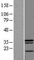 JKAMP Human Over-expression Lysate