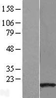 HSPC210 (GSKIP) Human Over-expression Lysate