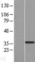C20orf111 (OSER1) Human Over-expression Lysate