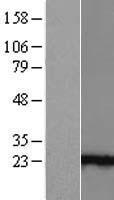 ANKRD39 Human Over-expression Lysate