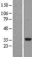 NT5C3 (NT5C3A) Human Over-expression Lysate