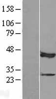 MAP3K12 binding inhibitory protein 1 (MBIP) Human Over-expression Lysate