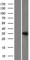 CYRIB Human Over-expression Lysate