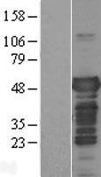 Tau (MAPT) Human Over-expression Lysate