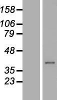 C21orf91 Human Over-expression Lysate