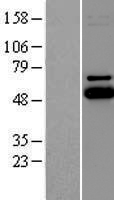 UBE2Q1 Human Over-expression Lysate