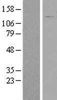 FAM29A (HAUS6) Human Over-expression Lysate