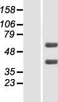 FLVCR2 Human Over-expression Lysate