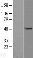 OXSM Human Over-expression Lysate