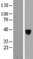 PAK1 interacting protein 1 (PAK1IP1) Human Over-expression Lysate