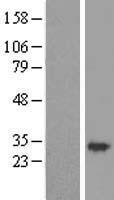 Gemin 8 (GEMIN8) Human Over-expression Lysate