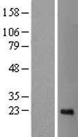 CDCA4 Human Over-expression Lysate