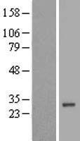 DSU (MREG) Human Over-expression Lysate