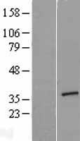ARGLU1 Human Over-expression Lysate