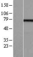 EFHC1 Human Over-expression Lysate
