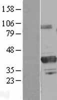 PRMT6 Human Over-expression Lysate