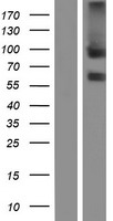 TEM8 (ANTXR1) Human Over-expression Lysate