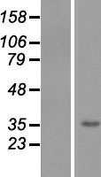 PACC1 Human Over-expression Lysate
