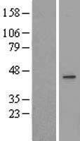 UEVLD Human Over-expression Lysate