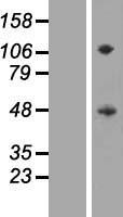 SIRPG Human Over-expression Lysate