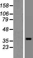 ELMOD1 Human Over-expression Lysate