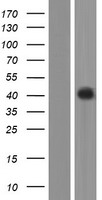 OPN1LW Human Over-expression Lysate