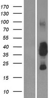 CEACAM19 Human Over-expression Lysate