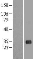 ACT (FHL5) Human Over-expression Lysate