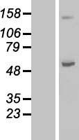 ABAT Human Over-expression Lysate