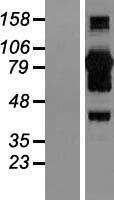 CoCoA (CALCOCO1) Human Over-expression Lysate