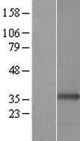 TNFAIP1 Human Over-expression Lysate