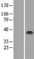 C20orf77 (RPRD1B) Human Over-expression Lysate