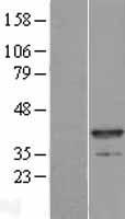 Myozenin 1 (MYOZ1) Human Over-expression Lysate