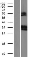 LAIR1 Human Over-expression Lysate