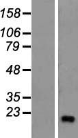 ZNF69 Human Over-expression Lysate